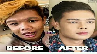 MGA SIKAT NA ARTISTA NA ANG LAKI NG PINAGBAGO!
