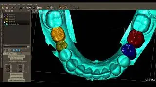 QuickVision 3D Tutorials - Waxup (slow)