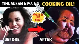 Supermodel, Bakit Tinurukan ng Mantika ang Sariling Mukha?