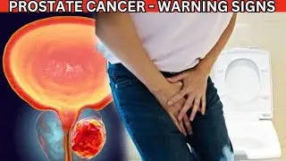Signs of Prostate Cancer in Males - Prostate Cancer Warning Signs