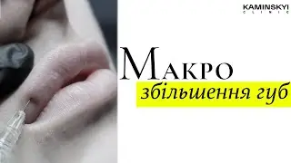 Макро збільшення губ #KAMINSKYI