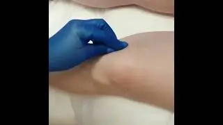 Плазмотерапия суставов