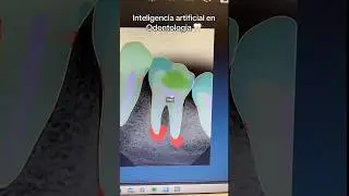 Diagnóstico con inteligencia artificial en odontologia ¿qué opinas?  Video de: Villalon.dr 🦷