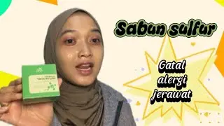 SULPHUR SOAP FOR ITCHY ACNE FACE AND BACK