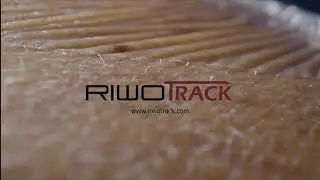 RIWOtrack electromagnetic navigation system for spine endoscopy