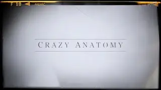 CRAZY ANATOMY - LA SERIE - Ep.#4 L' Avocado del Diavolo!!!