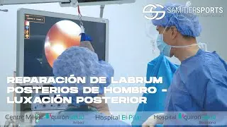 REPARACION DE LABRUM POSTERIOR DE HOMBRO. LUXACION POSTERIOR (Posterior shoulder instability)