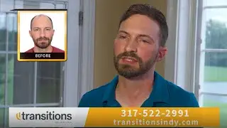 Hair Restoration Experts - Transitions of Indiana