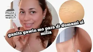MILIA /HOME REMEDY