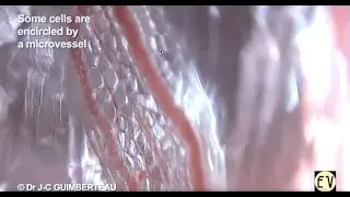 Dr Jean-Claude Guimberteau Interviewed by Dr Chikly: A New Way to Think About Anatomy - PART 2