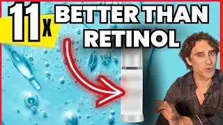 BETTER THAN RETINOL !!