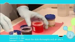 Semen analysis with CASA