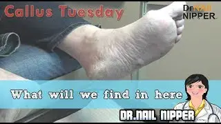 What will we find in here ???  - Callus Tuesday #34