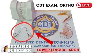 [CDT Exam] Let's make the Lower Lingual Arch from the Exam!