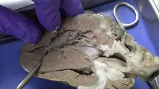Sheep Heart