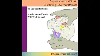 Superior Vertical Strain Pattern - Sustaining Governor Release