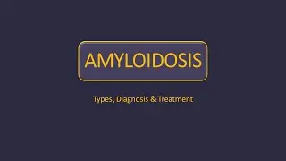 Amyloidosis - Types, Diagnosis & Treatment