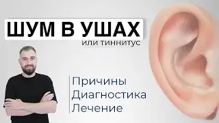 ШУМ В УШАХ ИЛИ ТИННИТУС. Причины, диагностика, лечение