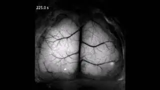 Cortex-wide neural interfacing via transparent polymer skulls