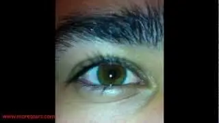 Eye Reference for Digital Painting