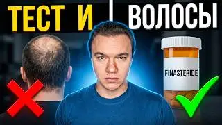 Лечение геморроя. Тестостерон и облысение. Пролактинома и стероиды. Анализы во время курса.