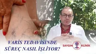 Varis Tedavisinde Süreç Nasıl İşliyor?