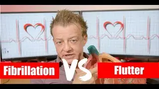 Afib vs Aflutter: What's the difference?