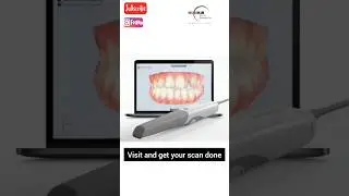 3D Intra Oral Scanning of your Teeth #cadcam #digital #smilemakeover