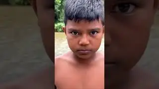 Hulk BOY Scary transformation | hulk Transformation 