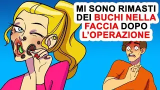 Ho Dei Buchi Sulla Faccia