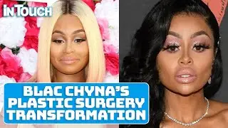 Blac Chyna’s Plastic Surgery Transformation