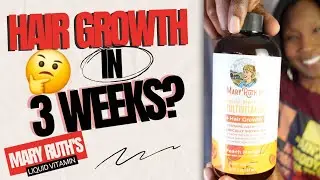 WHY MARY RUTH LIQUID MULTIVITAMIN HAIR GROWTH IS WORTH THE HYPE | Before & After Pictures