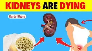 8 Warning Signs of Kidney Problems You Must Not Ignore
