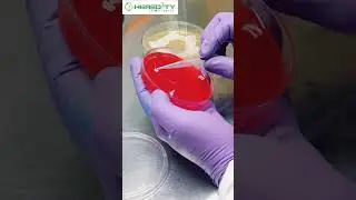 Candida blood Agar Test