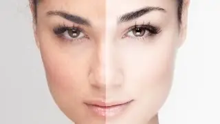 Tutorial Photoshop sul Ritocco della Pelle Professionale