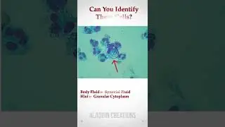 Can you identify these Cells In Body Fluid ? 🧐🙄🤔 #Quiz 373