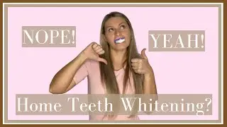 TRUTH about HOME TEETH WHITENING kits | what they don't tell you