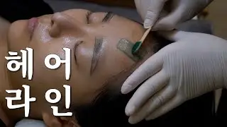 짧게보는 헤어라인 왁싱    Hairline waxing