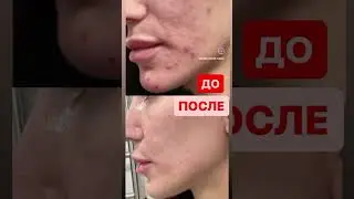 ДО и ПОСЛЕ лечения у доктора Юдиной М.М.