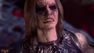 (Act 2 Spoilers) BG3 secret death scene