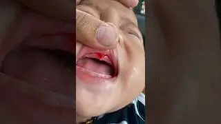GUSI BABY DIEGO BERDAR4H, DINAR NANGIS KEJER😢😭 