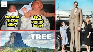 5 Biggest living things in the world that really exist | haviest Baby | biggest Tree | tallest Man