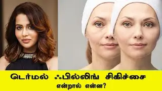 டெர்மல் பில்லிங் என்றால் என்ன? ரைசாவுக்கு நடந்தது என்ன? raiza wilson | complaint | labam