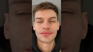 ME OPERÉ LA CARA? 