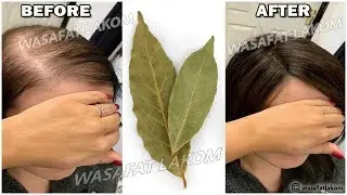 The Japanese secret , 🌿 to grow hair at a rocket speed and treat baldness from the first week