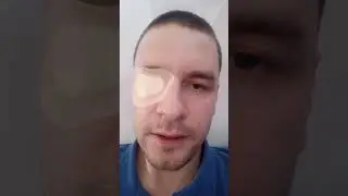 Замена хрусталика на ИОЛ J&J Tecnis Symfony торическая. г.Челябинск