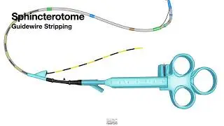 L#9 How To Exchange Spinchtotrome during ercp