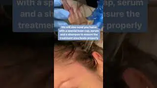 Transform Your Thinning Hair with Platelet-Rich Plasma