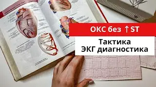 Инфаркт миокарда без подъема сегмента ST.  ЭКГ диагностика. Тактика. Часть 3.