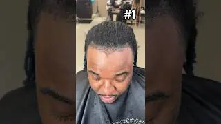 Hairline Fix ‼️ pt 5 💈🤷🏾‍♂️